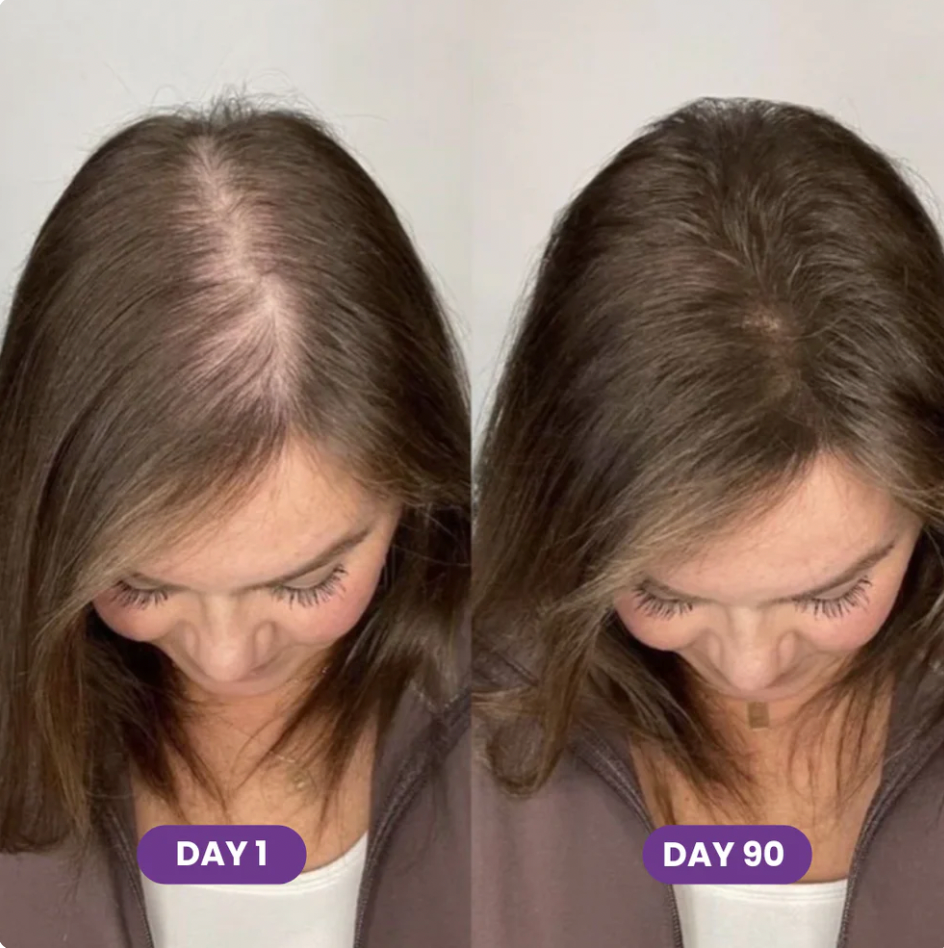 Hair Growth Accelerator Soft Chews