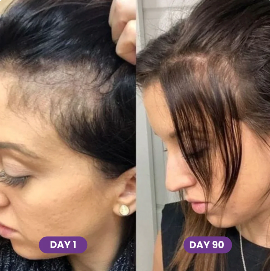 Hair Growth Accelerator Soft Chews