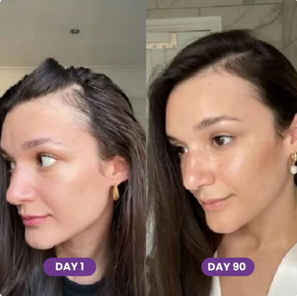 Hair Growth Accelerator Soft Chews